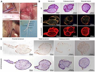 Differences in the Structure and Protein Expression of Femoral Nerve Branches in Rats